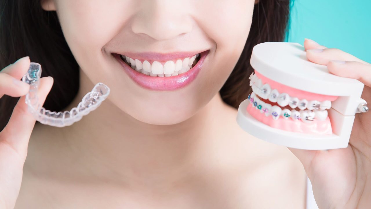 Harmonious Facial Structure Supported Through Premium Clear Aligner Treatment